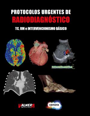 Protocolos urgentes de radiodiagnóstico